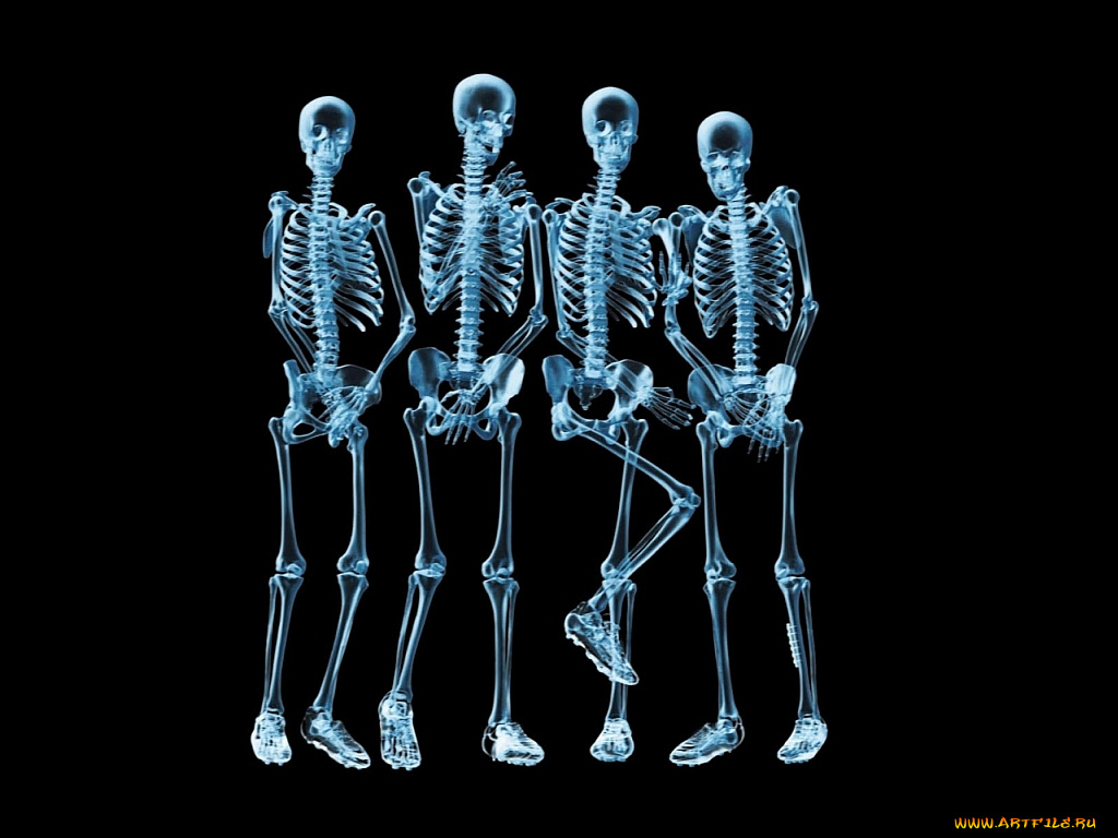разное, кости, рентген, скелеты, ренген