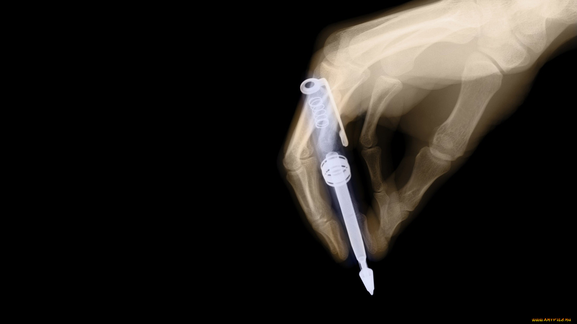 разное, кости, , рентген, рука, ручка