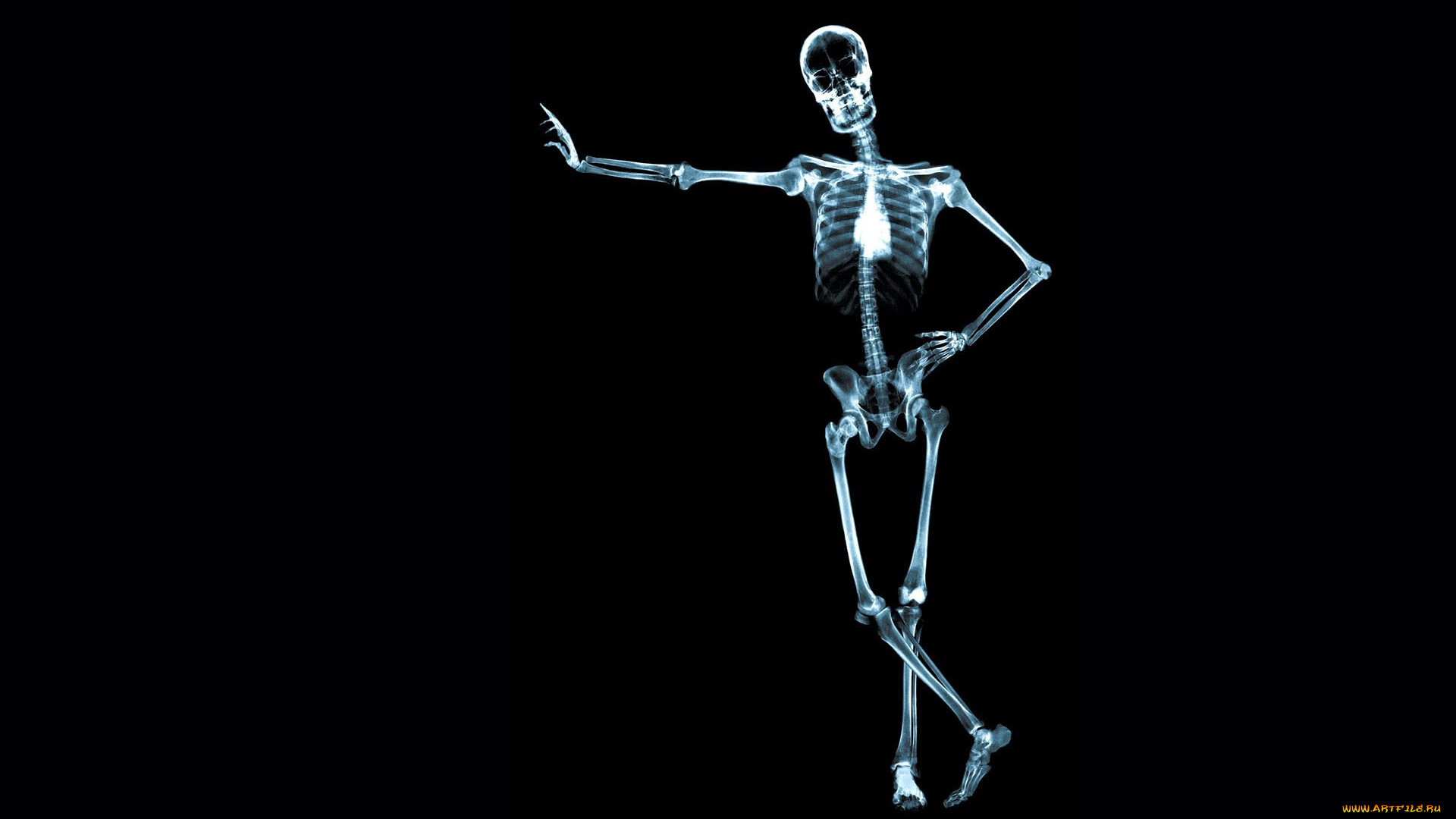 разное, кости, , рентген, скелет, человек