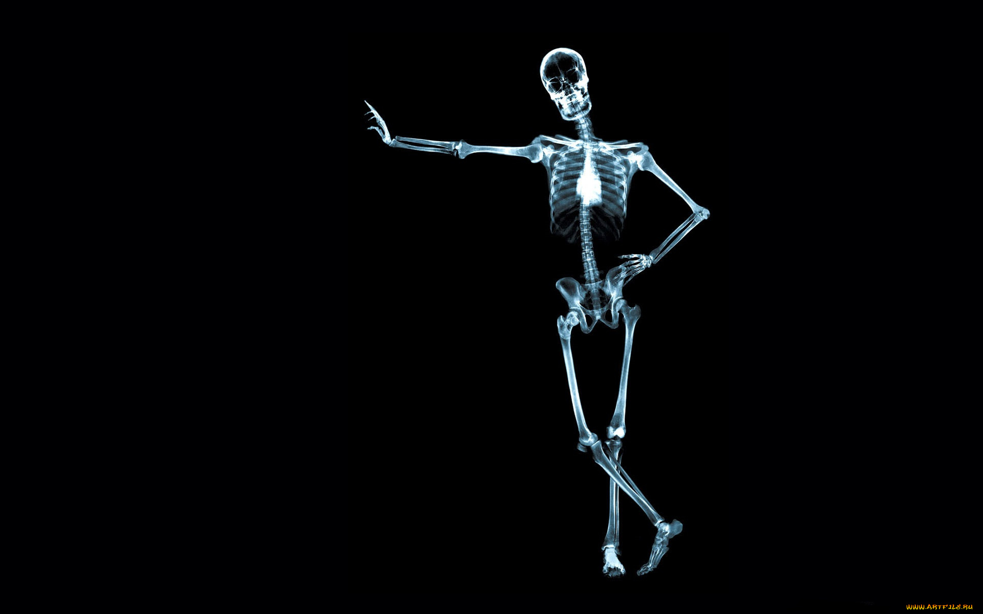 разное, кости, , рентген, скелет, человек