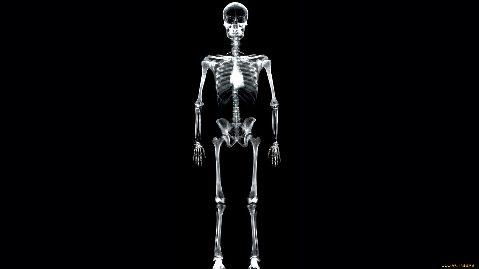 разное, кости, , рентген, скелет