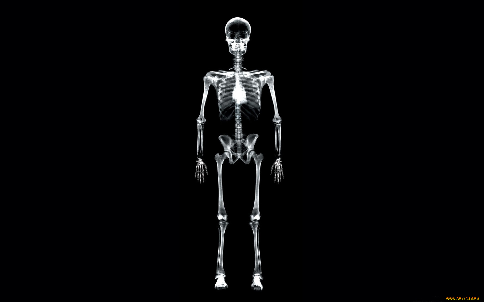 разное, кости, , рентген, скелет